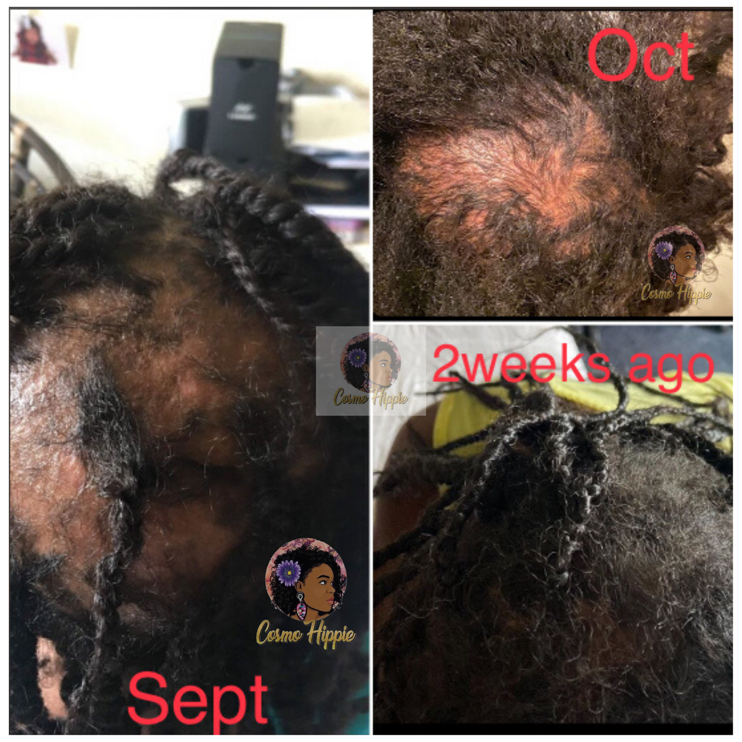 “I AM GROWING” Herbal Hair Growth Oil